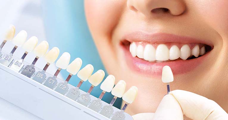 ホワイトニング